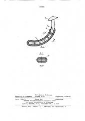 Колесо транспортного средства (патент 1082631)