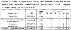 Способ забора конденсата выдыхаемого воздуха новорожденных, находящихся на искусственной вентиляции (патент 2629388)