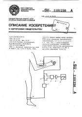 Способ поиска точек акупунктуры (патент 1101230)