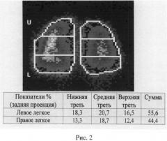 Способ дифференциальной диагностики хронической обструктивной болезни легких и бронхиальной астмы (патент 2483677)