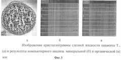 Способ дифференциальной диагностики инфекционно-воспалительных осложнений при травме глаза (патент 2356053)