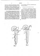 Эндопротез (патент 1800980)