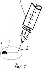 Инструмент для имплантации интракорнеальной оптической линзы для коррекции пресбиопии (патент 2581762)