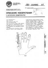 Устройство для фиксации костных отломков (патент 1324665)