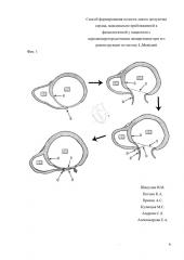Способ формирования полости левого желудочка сердца, максимально приближенной к физиологичной, у пациентов с переднеперегородочными аневризмами при его реконструкции по методу l. menicanti (патент 2620049)