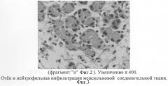 Способ моделирования острого некротического панкреатита (патент 2286608)