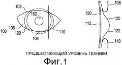 Податливые динамические зоны перемещения для контактных линз (патент 2575054)