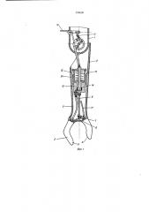 Протез верхней конечности (патент 598608)