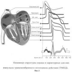 Способ выделения начала кардиоцикла (патент 2359606)