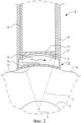 Устройство для миниинвазивного ультразвукового лечения болезни диска (патент 2270707)