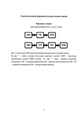 Способ усиленной наружной контрпульсации сердца (патент 2580977)