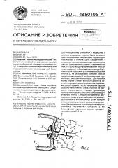 Способ формирования анастомоза протока паренхиматозного органа с полым органом (патент 1680106)