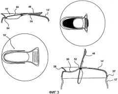 Способ и устройство для литья под давлением части упаковочного контейнера (патент 2429966)
