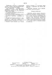 Крепление протеза нижней конечности (патент 1627174) Крепление протеза нижней конечности (патент 1627174)