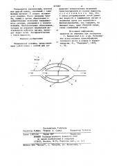 Медицинская ловушка (патент 825087)