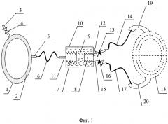 Способ искусственного кровообращения и устройство для его осуществления (патент 2633947)