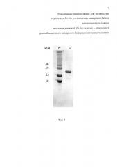Рекомбинантная плазмида для экспрессии в дрожжах pichia pastoris гена химерного белка ангиогенина человека и штамм дрожжей pichia pastoris - продуцент рекомбинантного химерного белка ангиогенина человека (патент 2658758)
