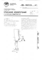 Протез бедра (патент 1627173)