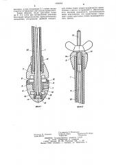 Способ формирования отсроченных анастомозов полых органов и устройство для его осуществления (патент 1263233)