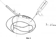 Способ ревизии органов мошонки (патент 2568767)