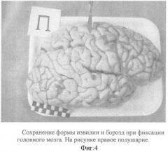 Способ фиксации головного мозга человека без вскрытия полости черепа (патент 2360612)