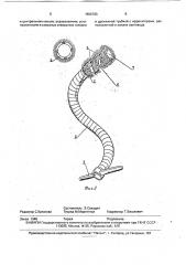 Устройство для обработки раневой поверхности костно- мозговых каналов (патент 1806783)