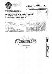 Устройство для закрытия колостомы (патент 1175444)