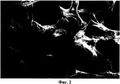 Матрикс для костного имплантата и способ его получения (патент 2532385)