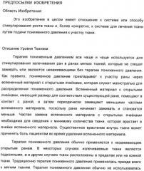 Способ лечения путем подкожной подачи пониженного давления с использованием разделения с помощью воздушного баллона (патент 2405588)