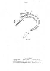 Устройство для извлечения эмбрионов у животных (патент 1584936)