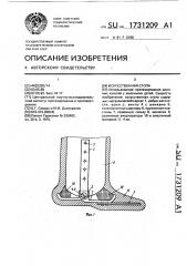 Искусственная стопа (патент 1731209)