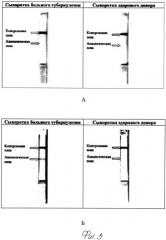 Способ проведения иммунохроматографического анализа для серодиагностики (патент 2532352)