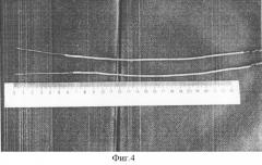 Способ электролизной деструкции нерезектабельных злокачественных опухолей печени (патент 2326618)