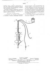 Устройство для остановки кровотечения в пищеводе и кардии (патент 418182)