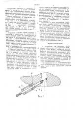 Устройство для иссечения мягких тканей (патент 1421319)