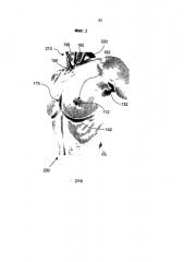 Распознавание анатомических характеристик и размерный анализ объема груди для обеспечения хирургии груди (патент 2604710)
