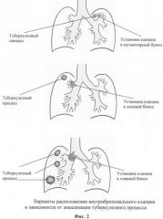Способ лечения туберкулеза легких (патент 2244517)