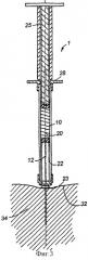 Устройство для инъекции композиции в жидкой или полутвердой форме (варианты) (патент 2257919)