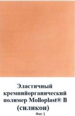 Способ модификации базисных материалов из акриловых пластмасс или силиконов для съемных зубных протезов, обтураторов и компонентов челюстно-лицевых протезов золотом и золотыми сплавами (патент 2510251)