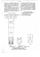 Устройство для зажима стержня руля велосипеда (патент 779156)