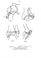 Устройство для остеосинтеза (патент 1178434)