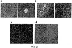 Способ получения мезенхимальных стволовых клеток из плюрипотентных стволовых клеток человека и мезенхимальные стволовые клетки, полученные этим способом (патент 2528250)
