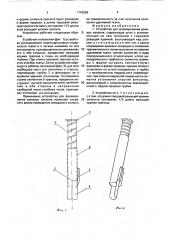 Устройство для формирования раневых каналов (патент 1743589)