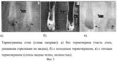 Тепловизионный комплекс для визуализации тепловых полей и измерения температур пациентов с дистальной гипотермией (патент 2432896)