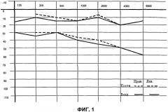 Способ прогнозирования восстановления слуховой функции у больных с острой сенсоневральной тугоухостью (патент 2545744)