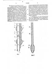 Способ лечения несостоятельности швов дуоденальной культи после резекции желудка по бильрот-11 (патент 1678385)