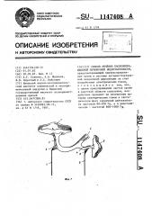 Способ лечения послеоперационной печеночной недостаточности (патент 1147408)