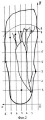 Способ определения локализации нормальных анатомических образований стопы (патент 2315563)