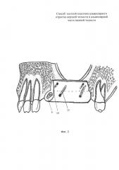 Способ костной пластики альвеолярного отростка верхней челюсти и альвеолярной части нижней челюсти (патент 2661039)