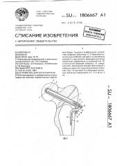 Устройство для остеосинтеза (патент 1806667)